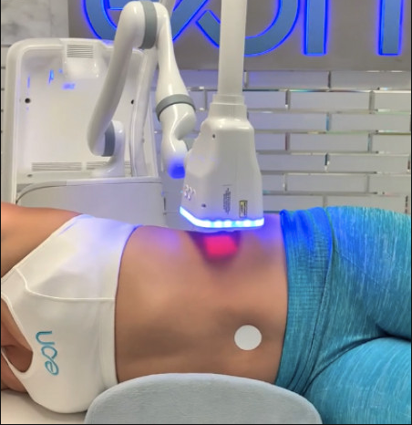 EON: The Revolutionary Robotic Body Contouring Device Expands its FDA Clearance for Back and Thighs