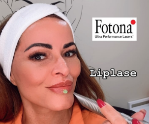 Plump Your Pout Naturally with Fotona4D – LipLase® at Rio Medical