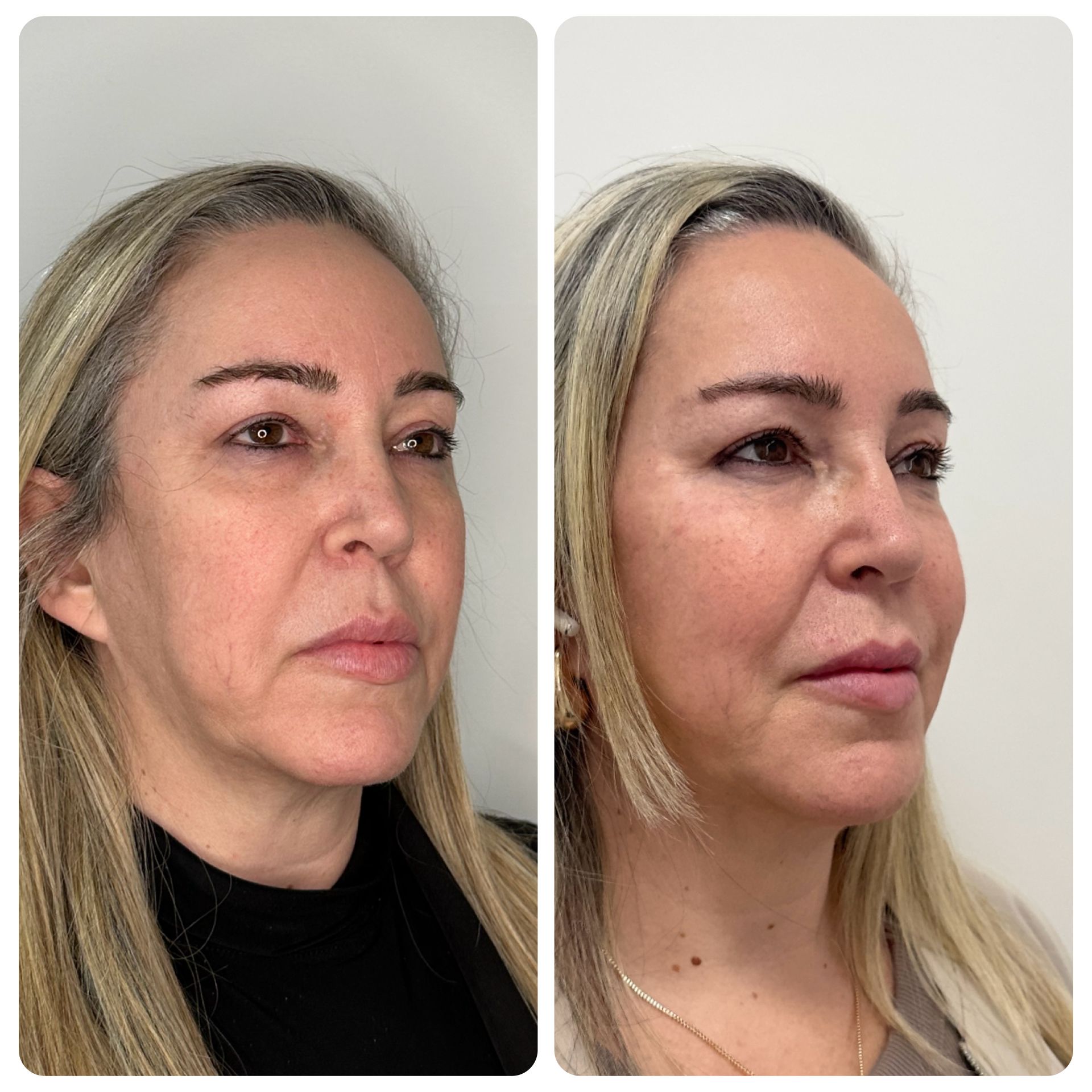 WhatsApp Image 2025-05-23 at 15.40.56