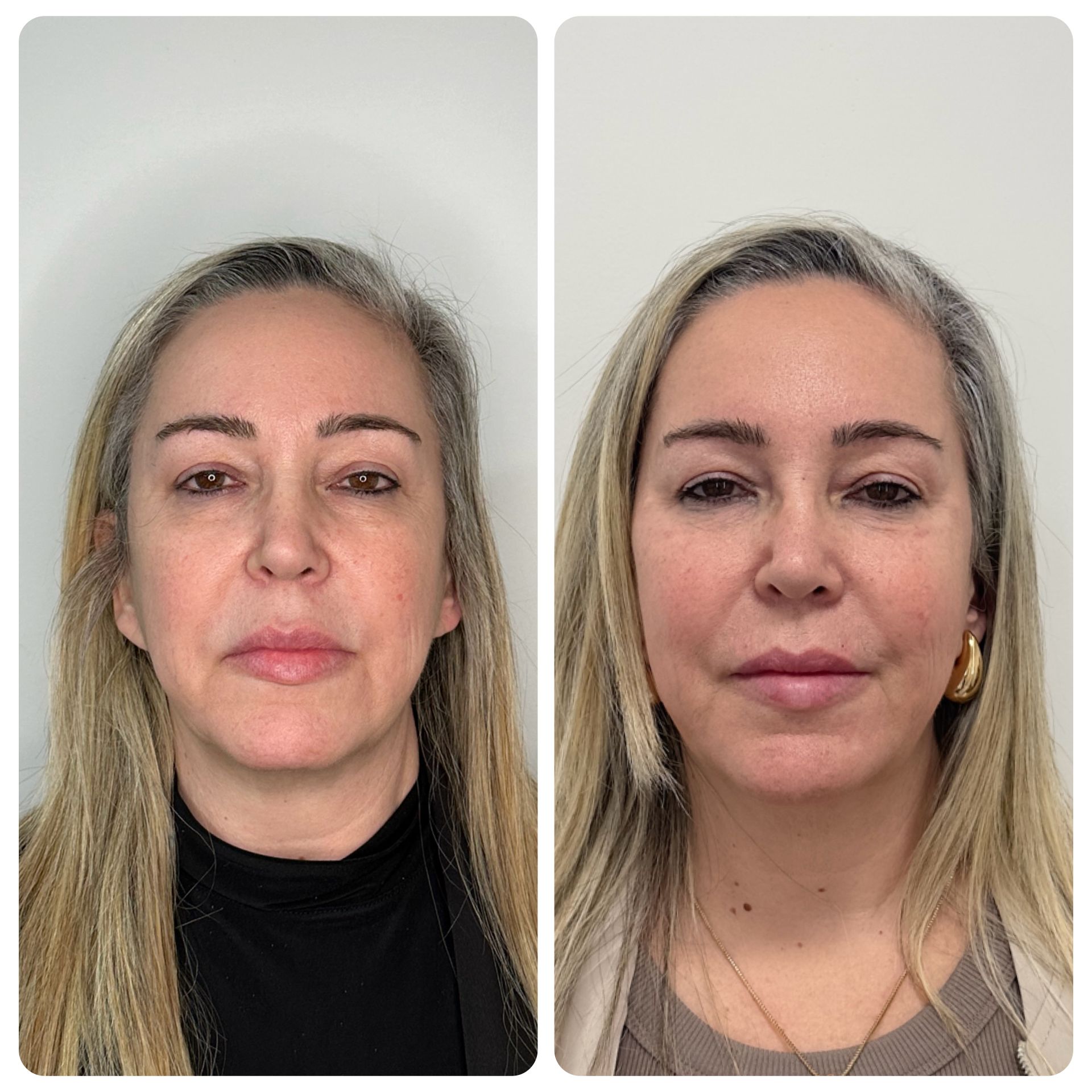 WhatsApp Image 2025-05-23 at 15.41.17