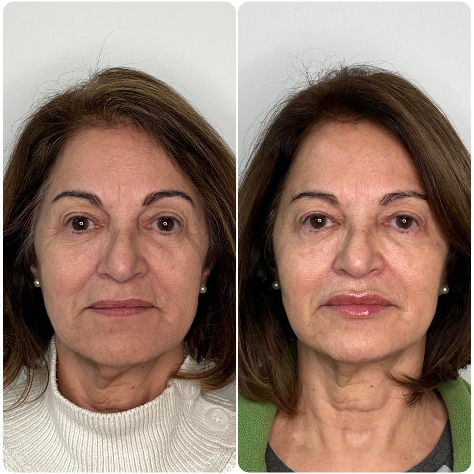 Before and After - Rio Medical WhatsApp Image 2025-06-23 at 19.27.17