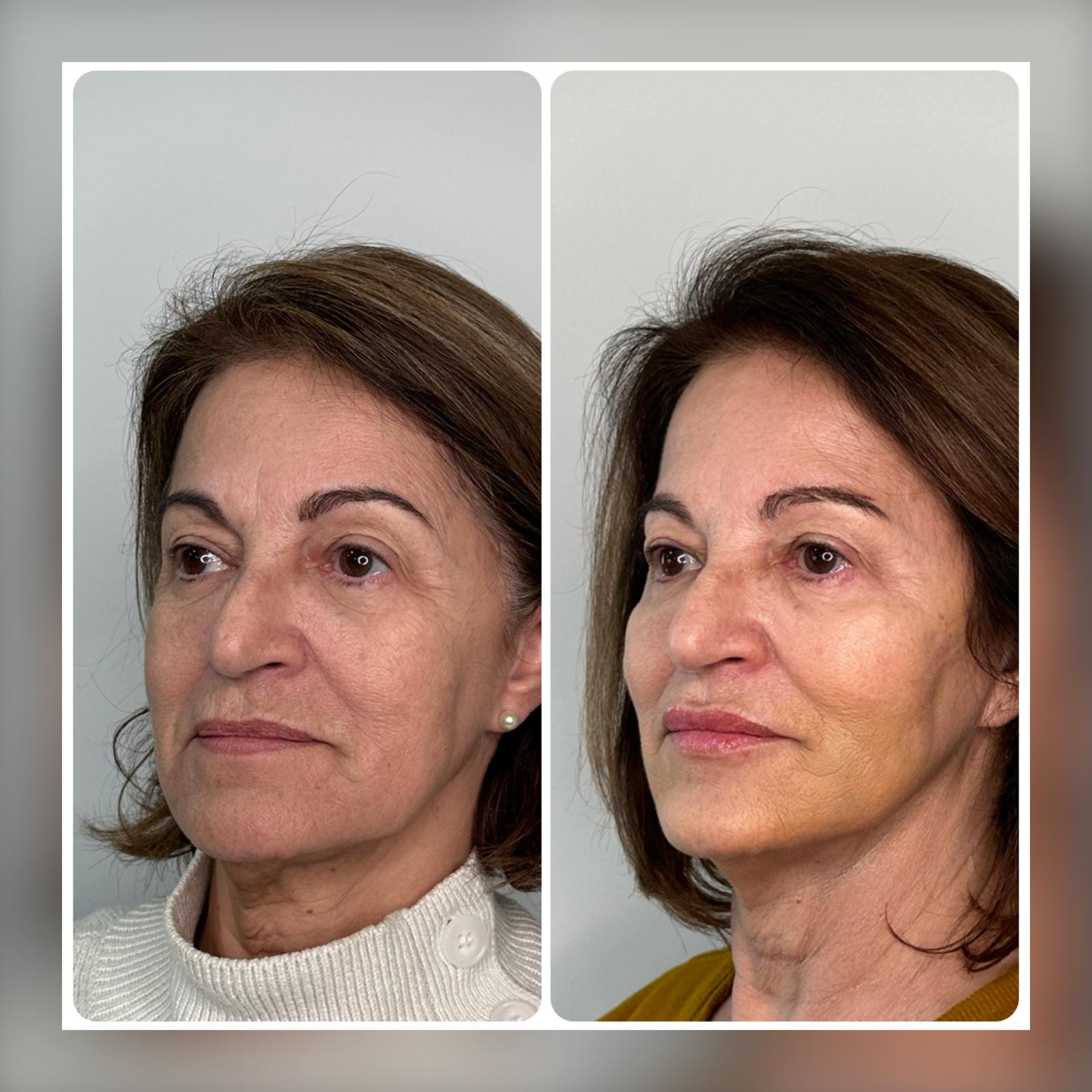 Before and After - Rio Medical WhatsApp Image 2025-06-23 at 19.27.26