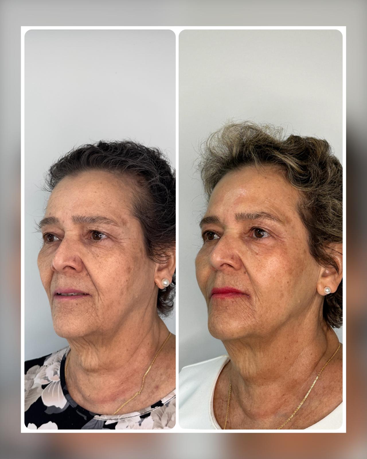 Before and After - Rio Medical WhatsApp Image 2025-06-23 at 19.27.51