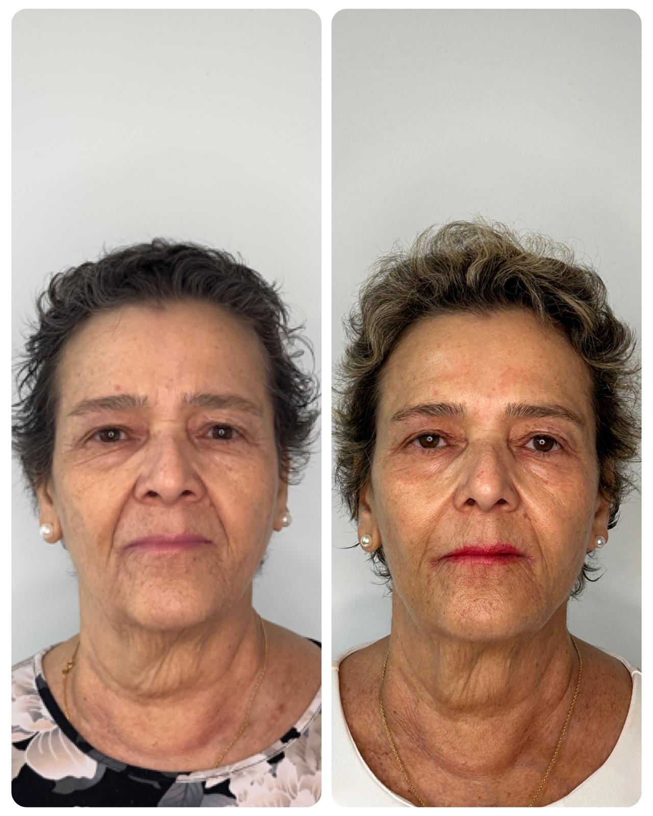 Before and After - Rio Medical WhatsApp Image 2025-06-23 at 19.28.06