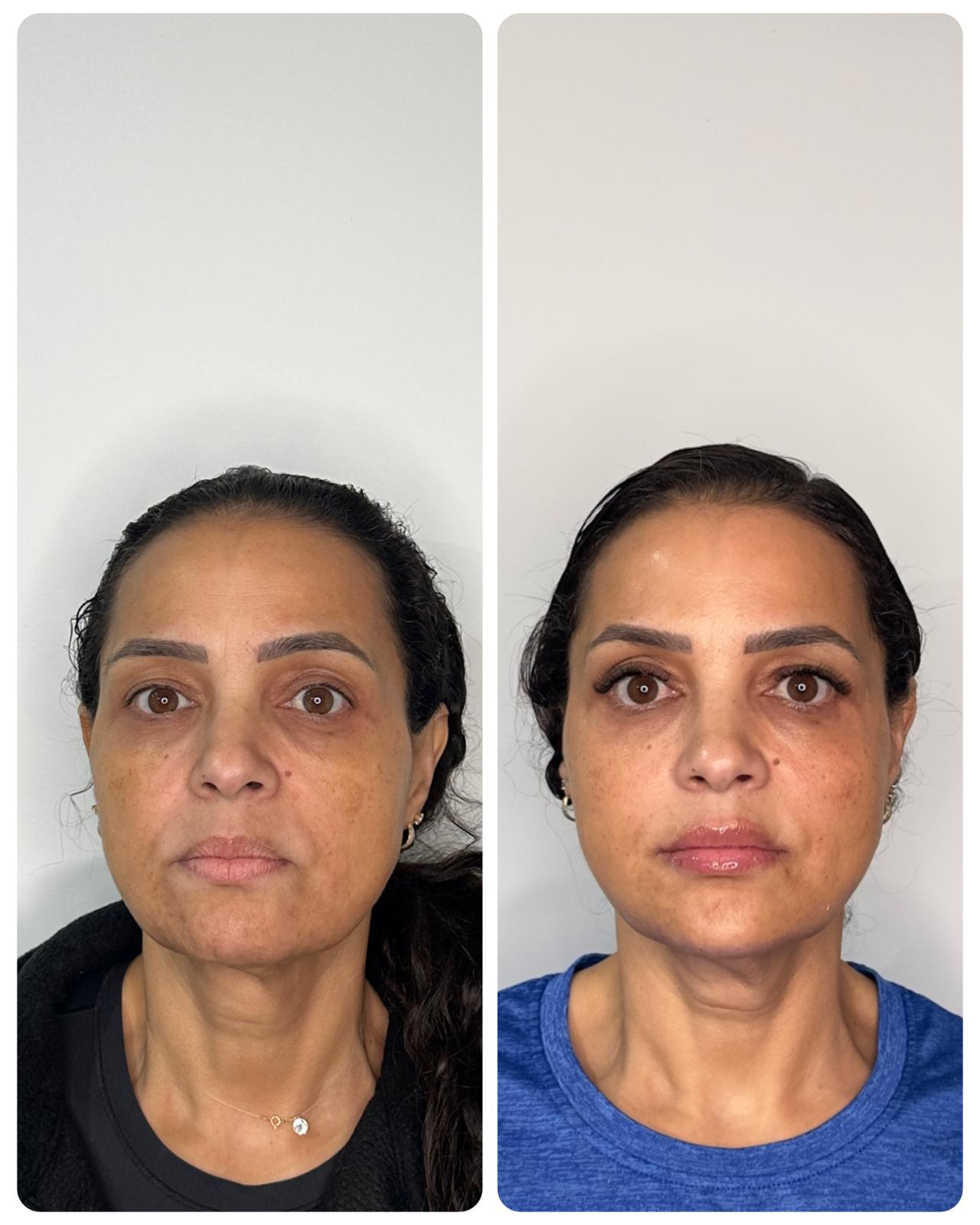 Before and After - Rio Medical WhatsApp Image 2025-06-23 at 19.28.20