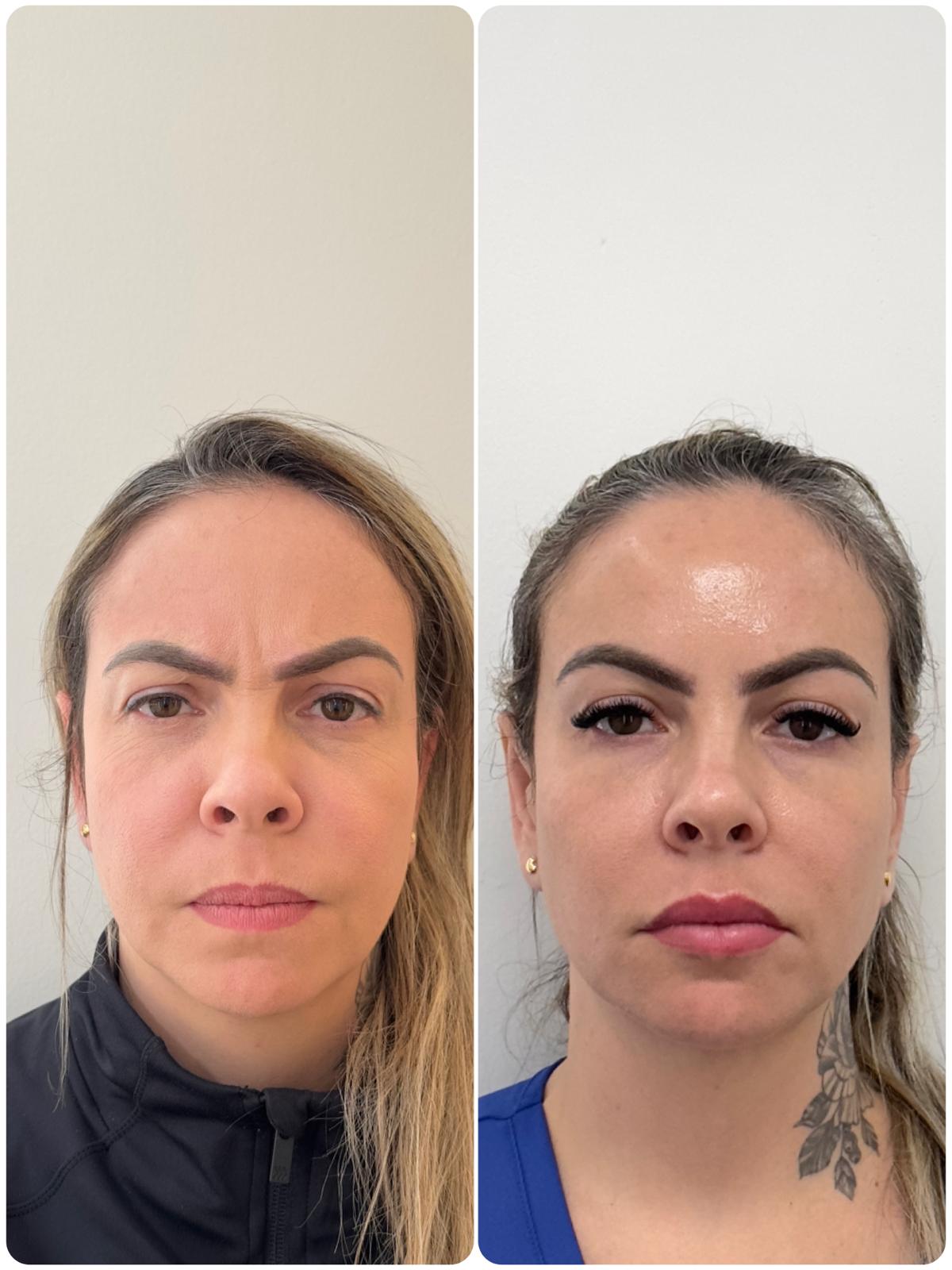 Before and After - Rio Medical WhatsApp Image 2025-06-23 at 19.28.28