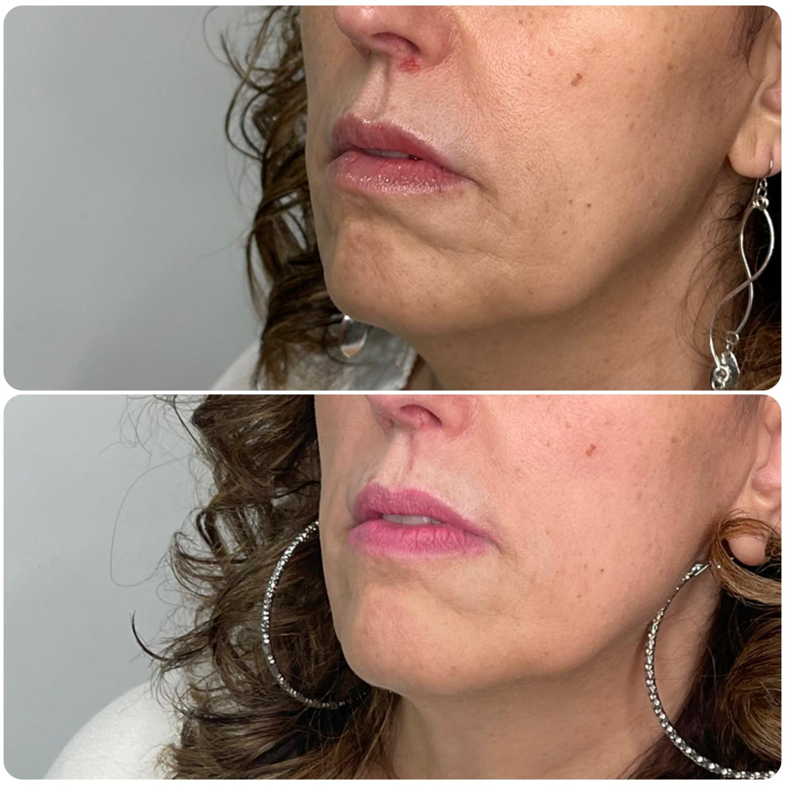 Before and After - Rio Medical WhatsApp Image 2025-06-23 at 19.30.44