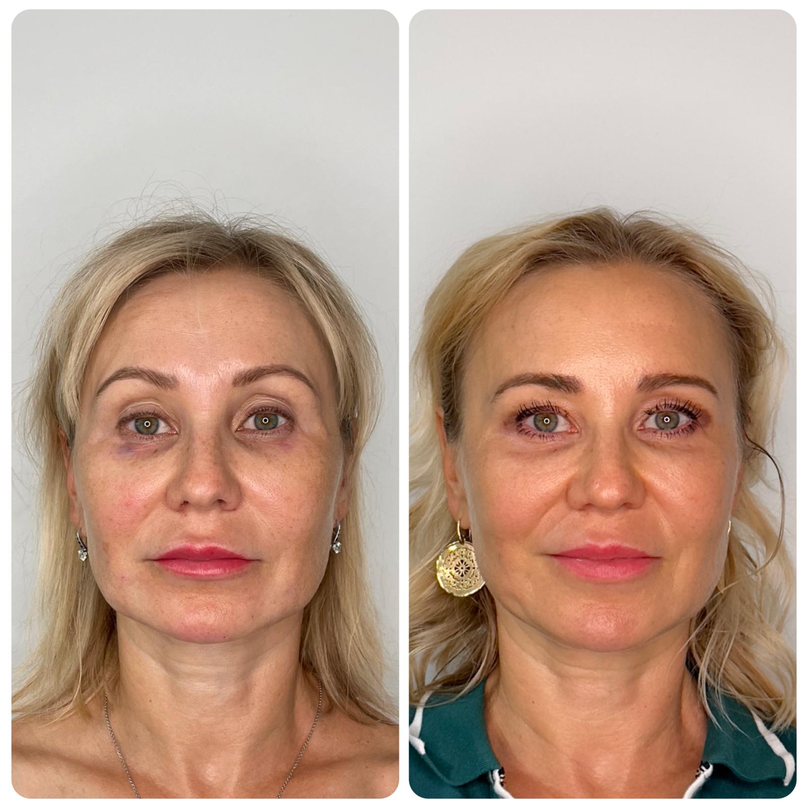 Before and After - Rio Medical WhatsApp Image 2025-06-23 at 19.35.58