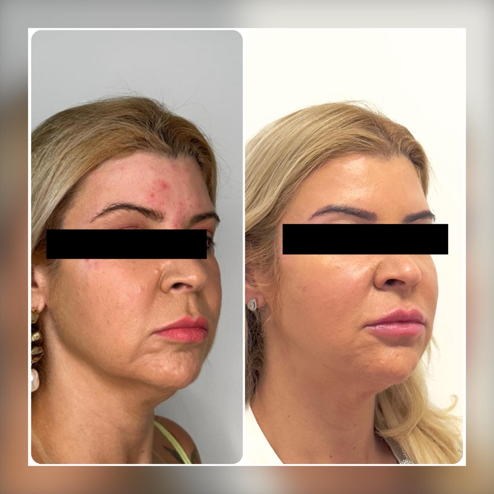 Before and After - Rio Medical WhatsApp Image 2025-06-23 at 19.36.05