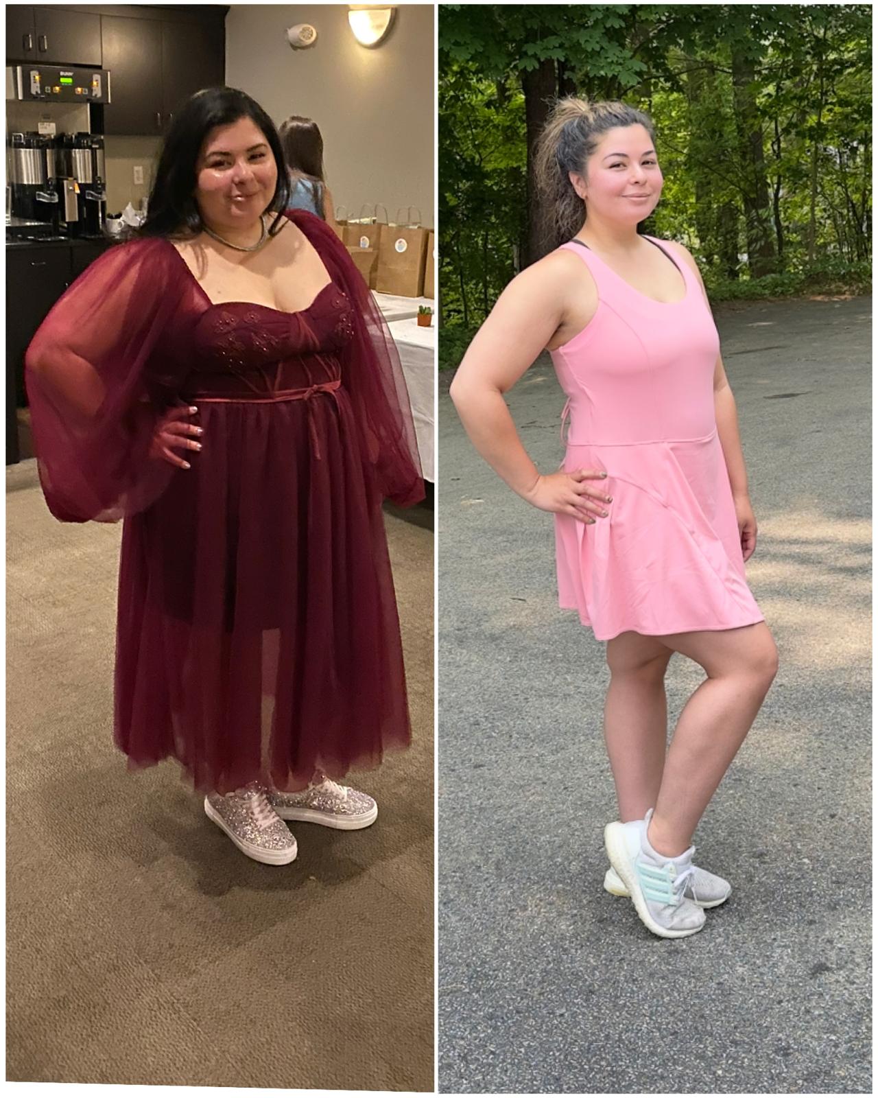 Before and After - Rio Medical WhatsApp Image 2025-06-23 at 19.36.10