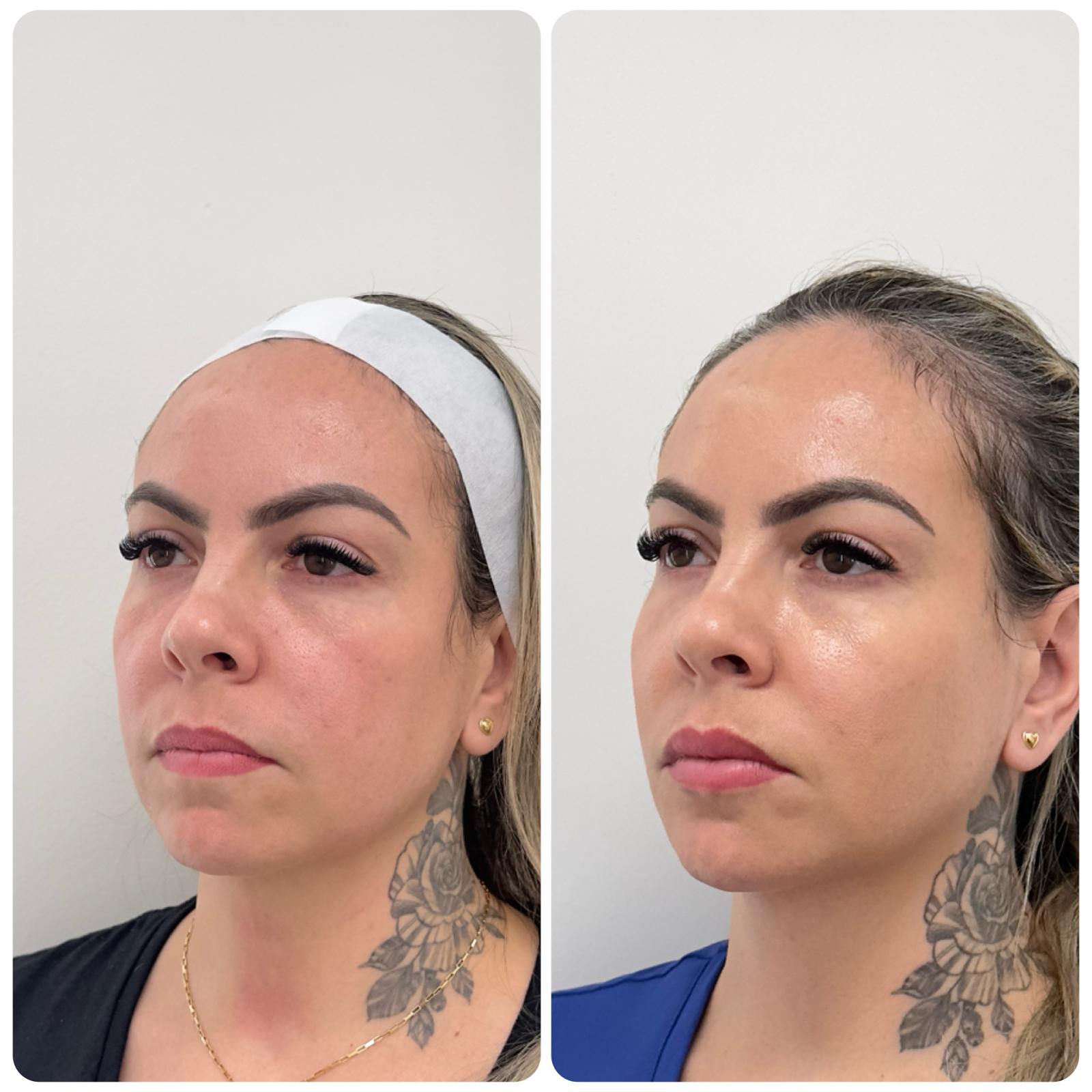 Before and After - Rio Medical WhatsApp Image 2025-06-23 at 19.36.17