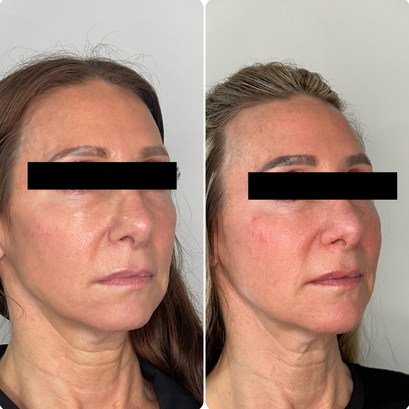 Before and After - Rio Medical WhatsApp Image 2025-06-23 at 19.36.35